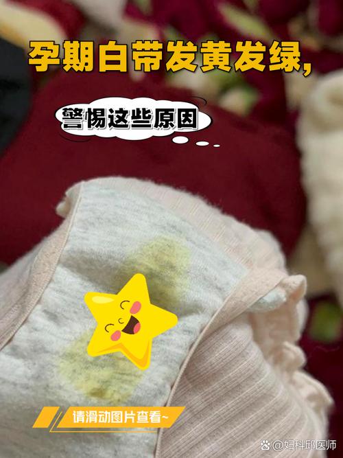 孕期内裤上的黄渍为何总洗不掉？是正常分泌物还是异常信号？-第2张图片-郑州医学网