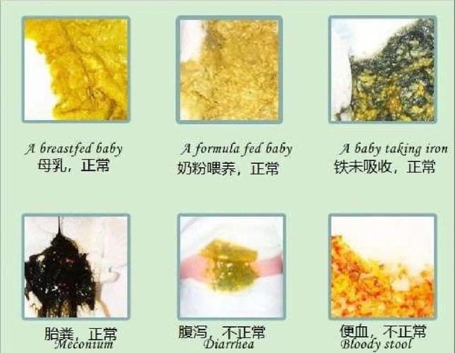 新生儿新生儿吸入粪便竟可存活？其背后医学奇迹与风险真相究竟如何？-第1张图片-郑州医学网
