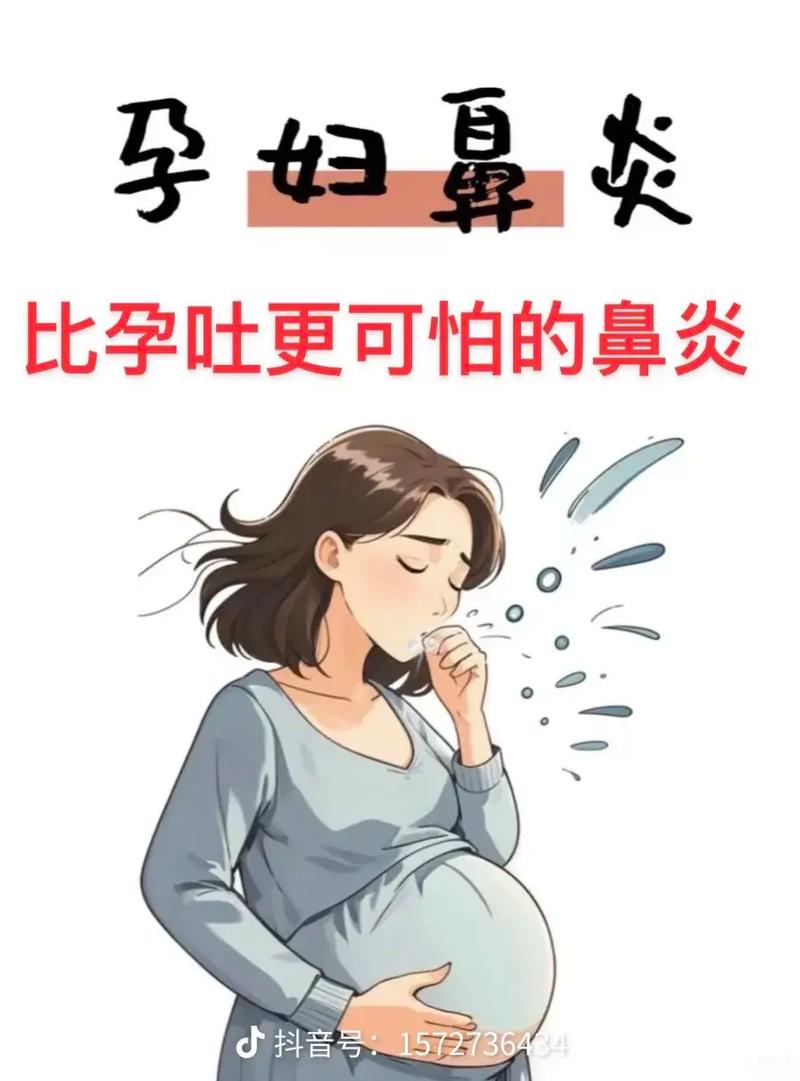 孕期感冒打喷嚏怎么办-第3张图片-郑州医学网