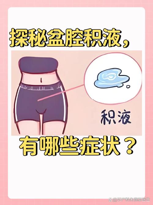 孕期宫腔积液是否必须长期平躺？不同情况下的姿势注意事项有哪些？-第2张图片-郑州医学网