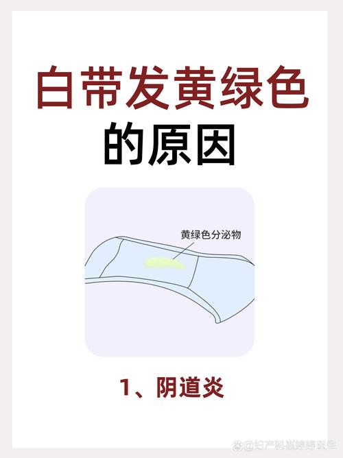 孕期白带呈现黄绿色真的是怀男孩的信号吗？这种说法有科学依据吗？-第1张图片-郑州医学网