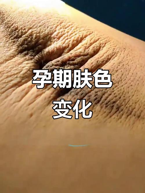怀孕期间脸色发黄发黑是身体发出的什么健康信号？-第1张图片-郑州医学网