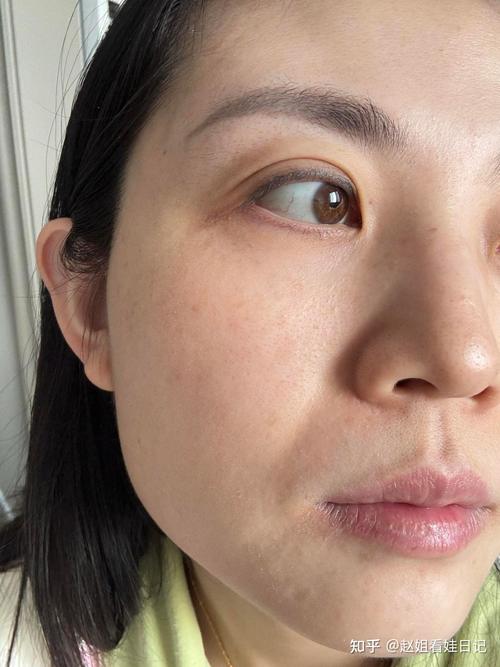 怀孕期间脸色发黄发黑是身体发出的什么健康信号？-第2张图片-郑州医学网