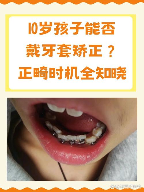 儿童牙齿矫正到底几岁最合适？过早或过晚矫正会有哪些影响？-第3张图片-郑州医学网