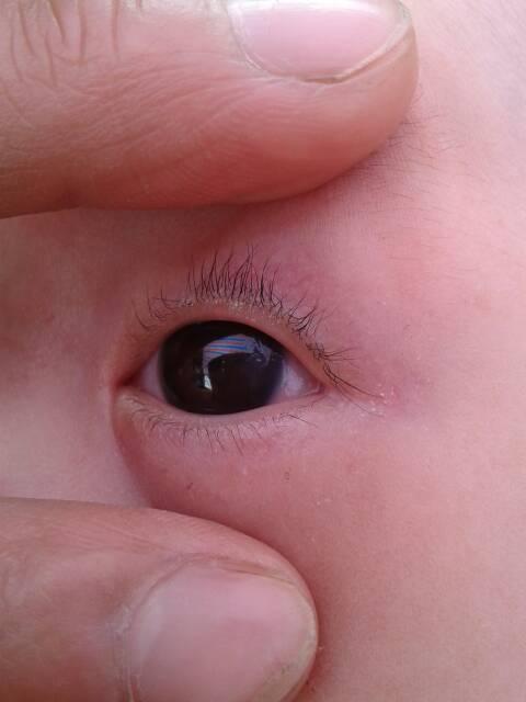 新生儿黑眼球发灰是正常现象还是异常信号？需警惕哪些眼部问题？-第1张图片-郑州医学网