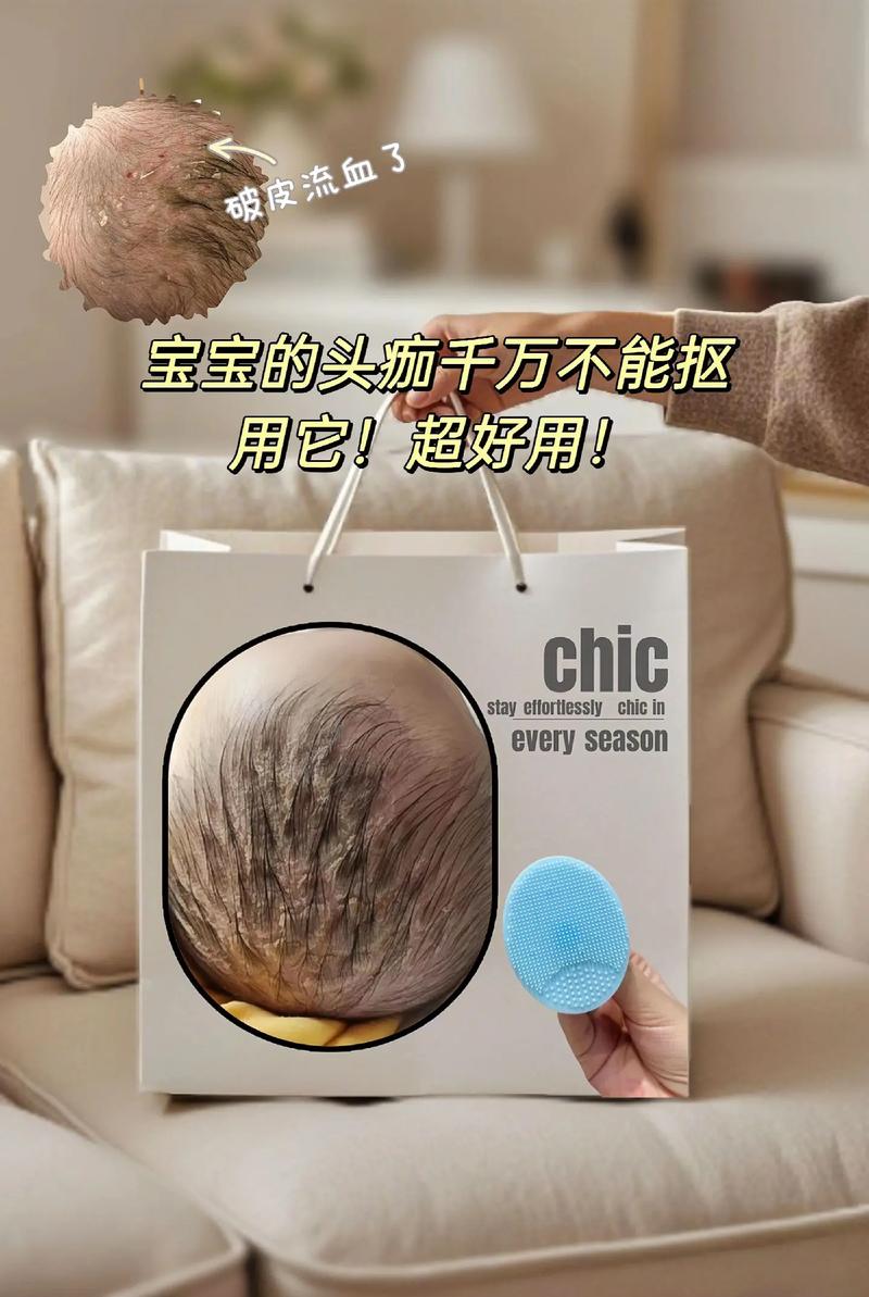 新生儿洗头发该用什么？安全无泪配方+正确手法指南，新手爸妈必看！-第2张图片-郑州医学网