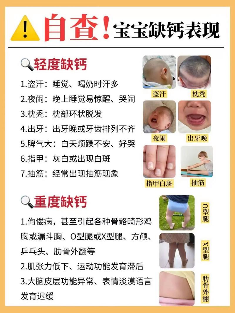 儿童补钙真的分季节吗?不同季节补钙效果差异有多大?-第1张图片-郑州医学网 儿童补钙真的分季节吗?不同季节补钙效果差异有多大?-第1张图片-郑州医学网