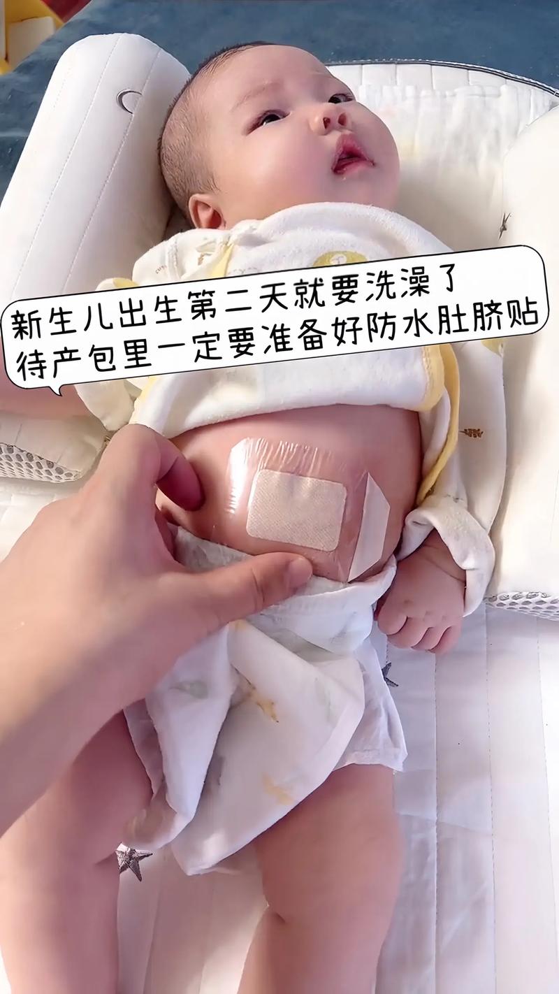 新生儿脐带不干怎么办?如何正确护理促进脱落?-第3张图片-郑州医学网 新生儿脐带不干怎么办?如何正确护理促进脱落?-第3张图片-郑州医学网