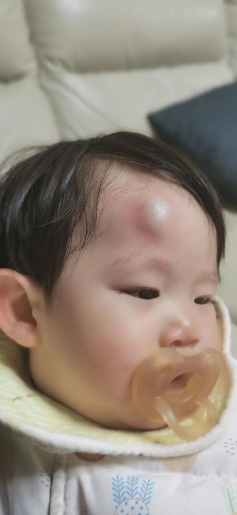 新生儿头上突然出现硬包是正常现象还是疾病信号？需要立即就医吗？-第3张图片-郑州医学网
