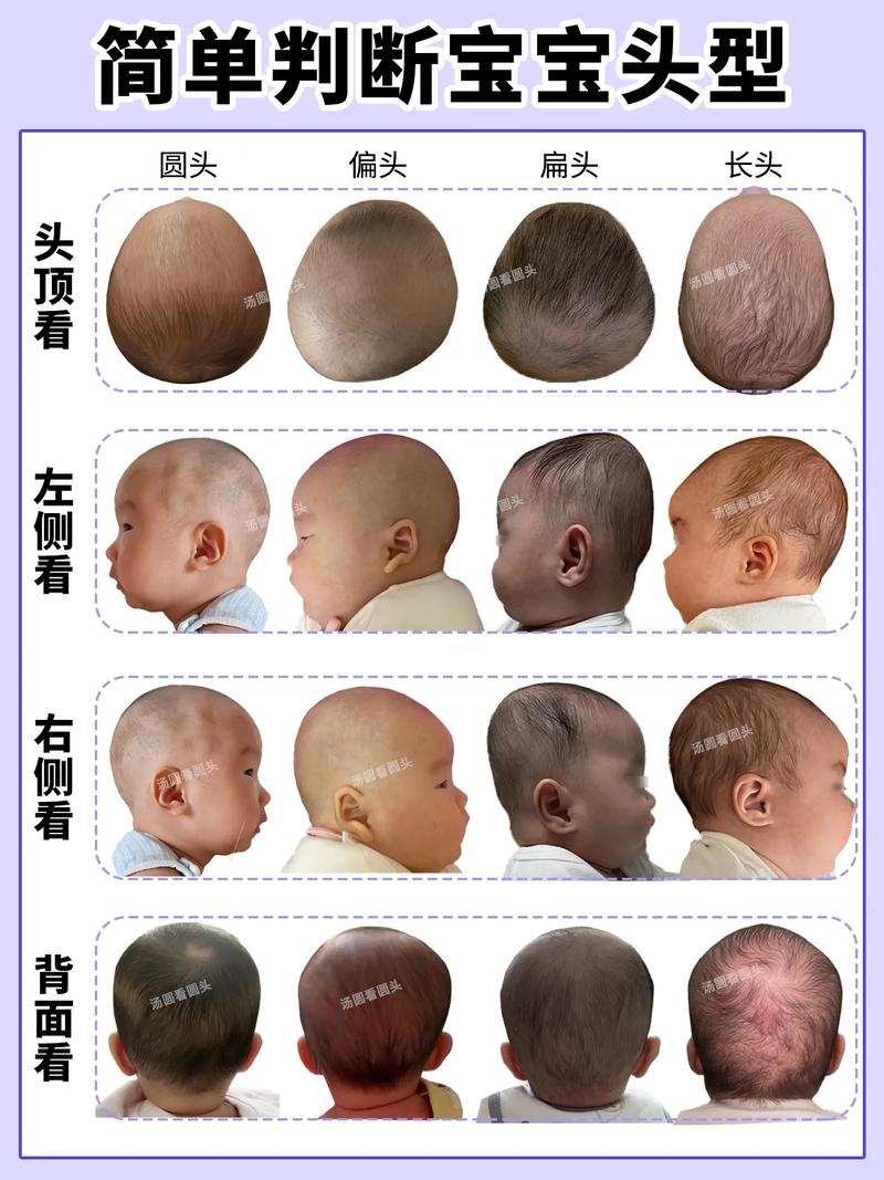 新生儿多大开始睡头型？最佳时机与科学方法是什么？-第2张图片-郑州医学网