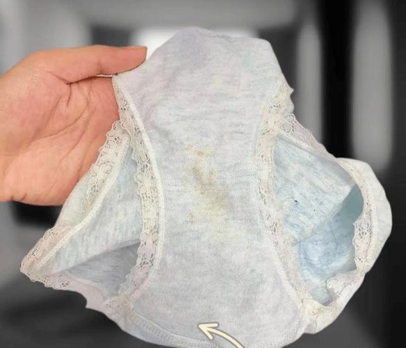 孕期分泌物发黄正常吗？是否需要就医检查呢？-第1张图片-郑州医学网