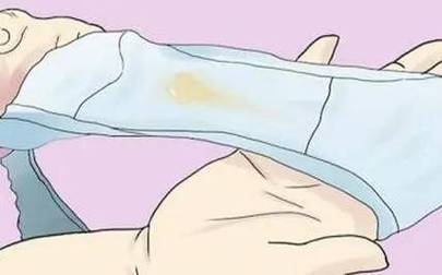 孕期分泌物发黄正常吗？是否需要就医检查呢？-第2张图片-郑州医学网