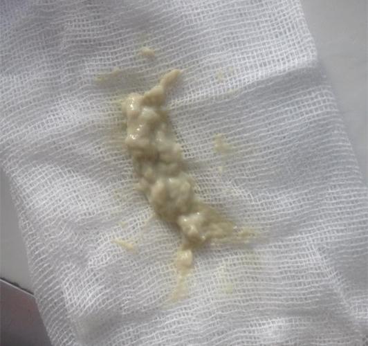 孕期分泌物发黄正常吗？是否需要就医检查呢？-第3张图片-郑州医学网