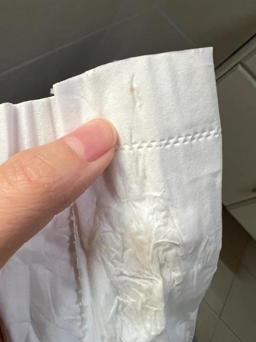 怀孕期间出现凝乳块状白带是正常现象吗？会对胎儿有影响吗？-第3张图片-郑州医学网