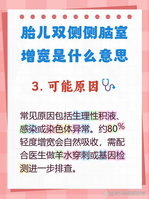 孕期胎儿脑积水如何治疗？有哪些安全有效的干预措施？-第2张图片-郑州医学网