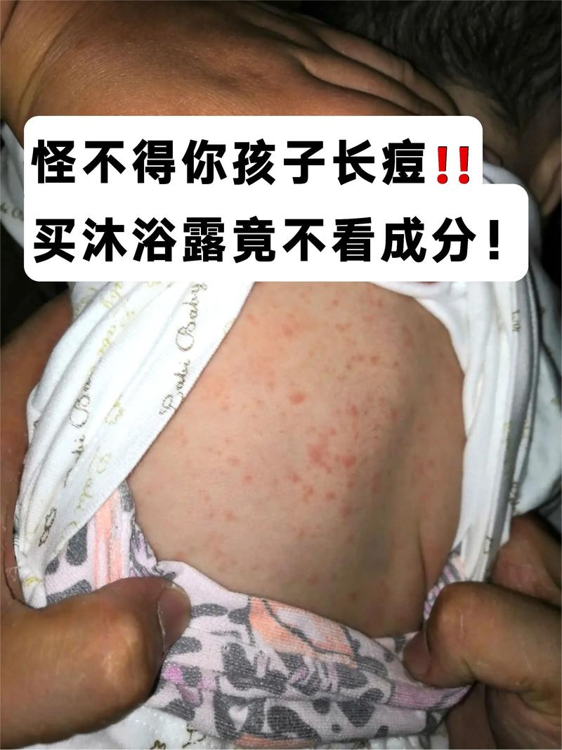 儿童沐浴露大人用会不会太温和导致清洁力不足？-第1张图片-郑州医学网