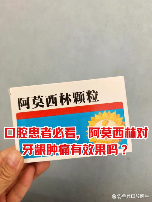 儿童牙龈红肿能自行用药吗？需警惕哪些用药误区？-第1张图片-郑州医学网