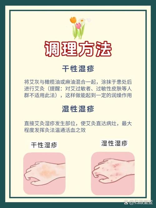 儿童湿疹反复发作，到底哪种方法才能真正有效根治且不复发？-第3张图片-郑州医学网