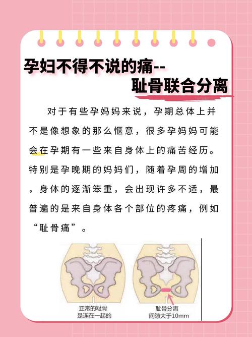 孕期骨头痛是什么原因?孕期为何会出现骨头痛?孕期骨头痛的诱因有哪些?-第1张图片-郑州医学网 孕期骨头痛是什么原因?孕期为何会出现骨头痛?孕期骨头痛的诱因有哪些?-第1张图片-郑州医学网