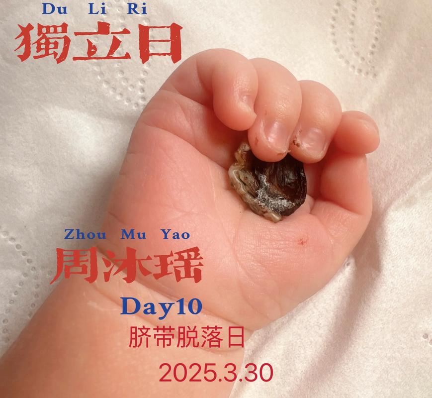 新生儿肚脐脱落过程中会感到疼痛吗？家长该如何正确护理避免不适？-第2张图片-郑州医学网