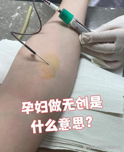 孕期做无创DNA检测到底要不要空腹？这会影响结果准确性吗？-第3张图片-郑州医学网