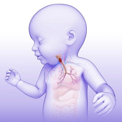 新生儿先天性食道闭锁的成因、早期识别与治疗策略有哪些关键点？-第3张图片-郑州医学网