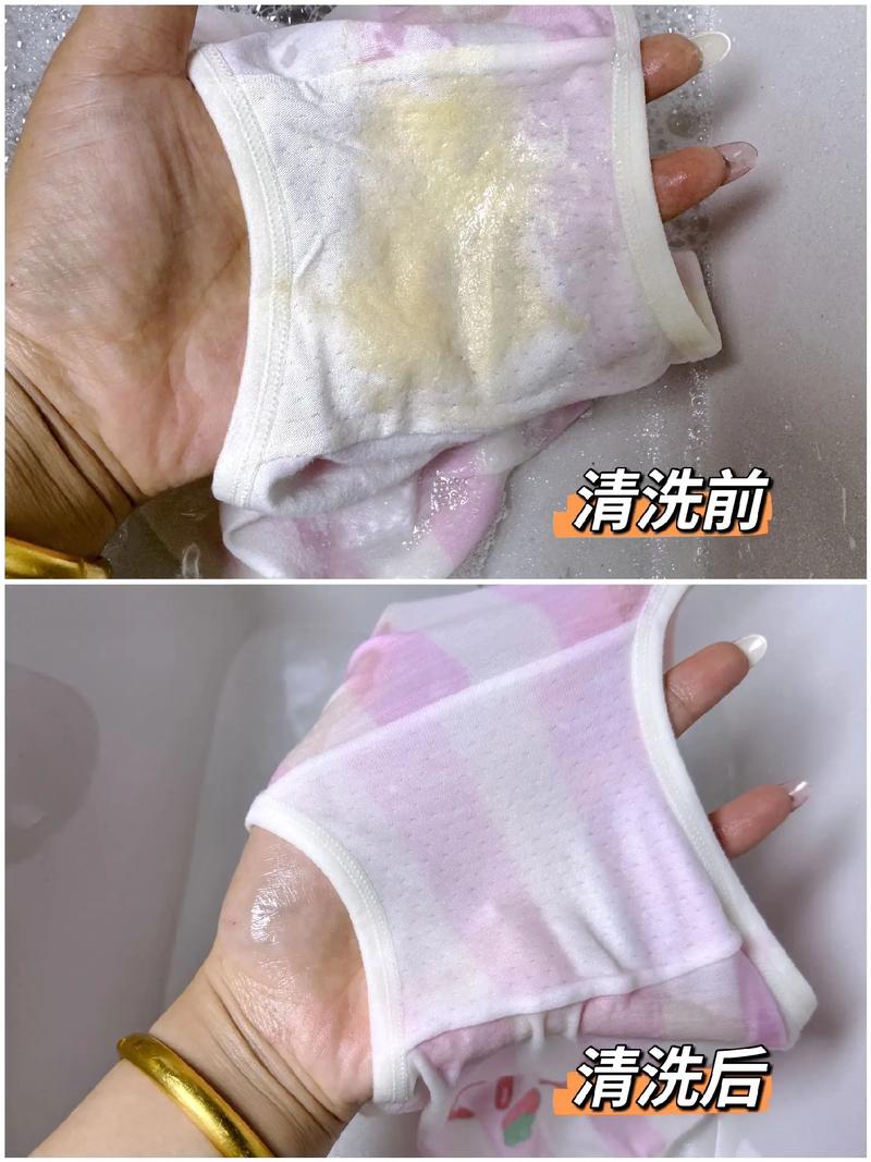 孕期内裤总是黄黄的，是正常生理变化还是健康预警？-第1张图片-郑州医学网