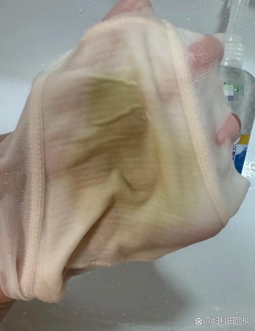 孕期内裤总是黄黄的，是正常生理变化还是健康预警？-第2张图片-郑州医学网