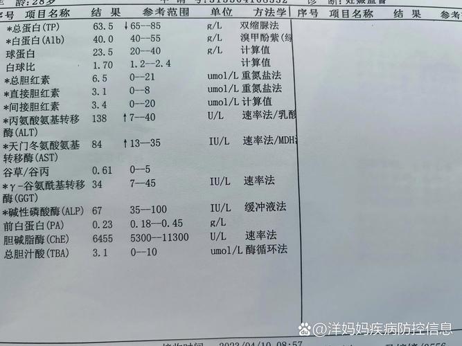 儿童丙氨酸氨基转移酶升高是肝脏出问题了吗？需要做哪些检查？-第2张图片-郑州医学网