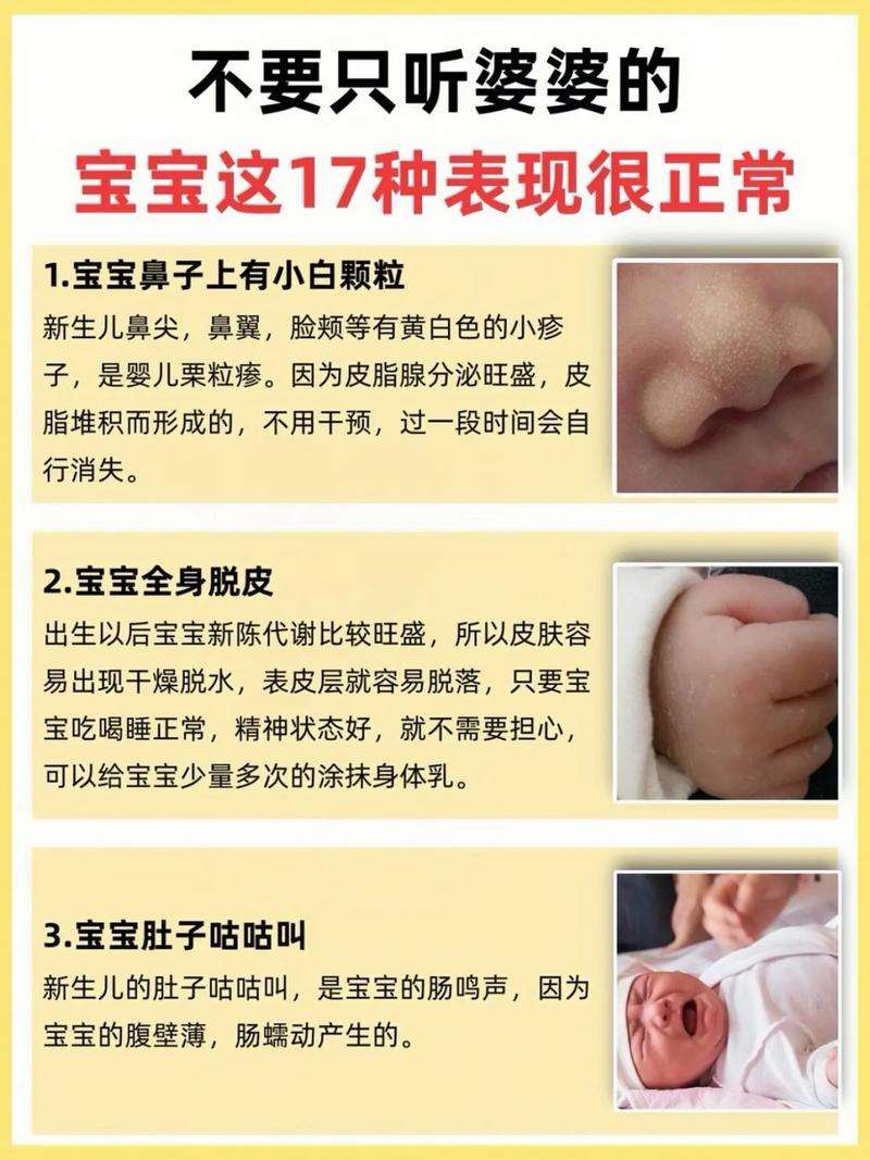 新生儿表现正常与否,家长该如何判断这些特征是否在正常范围内?-第1张图片-郑州医学网 新生儿表现正常与否,家长该如何判断这些特征是否在正常范围内?-第1张图片-郑州医学网