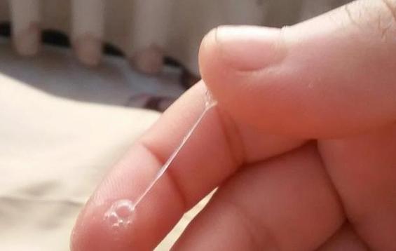 孕期乳头分泌物出现异味是正常现象吗？会对胎儿或哺乳有影响吗？-第3张图片-郑州医学网