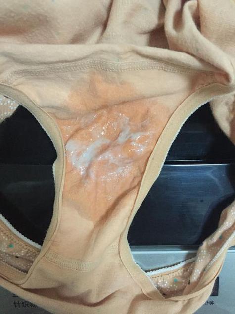 怀孕期正常白带图片是什么样子?变化范围与健康标准有哪些?-第3张图片-郑州医学网 怀孕期正常白带图片是什么样子?变化范围与健康标准有哪些?-第3张图片-郑州医学网