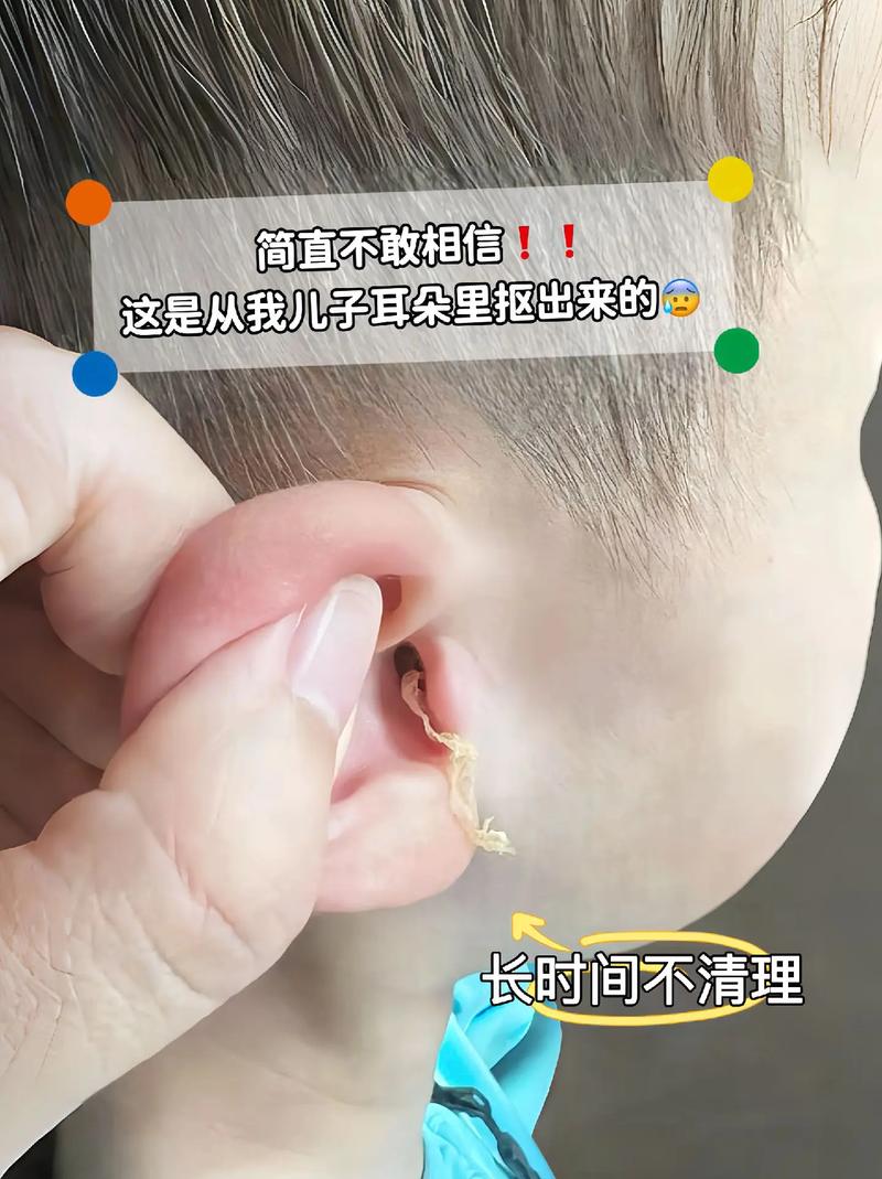 新生儿耳朵需要揪吗？揪耳朵会影响听力发育吗？-第2张图片-郑州医学网