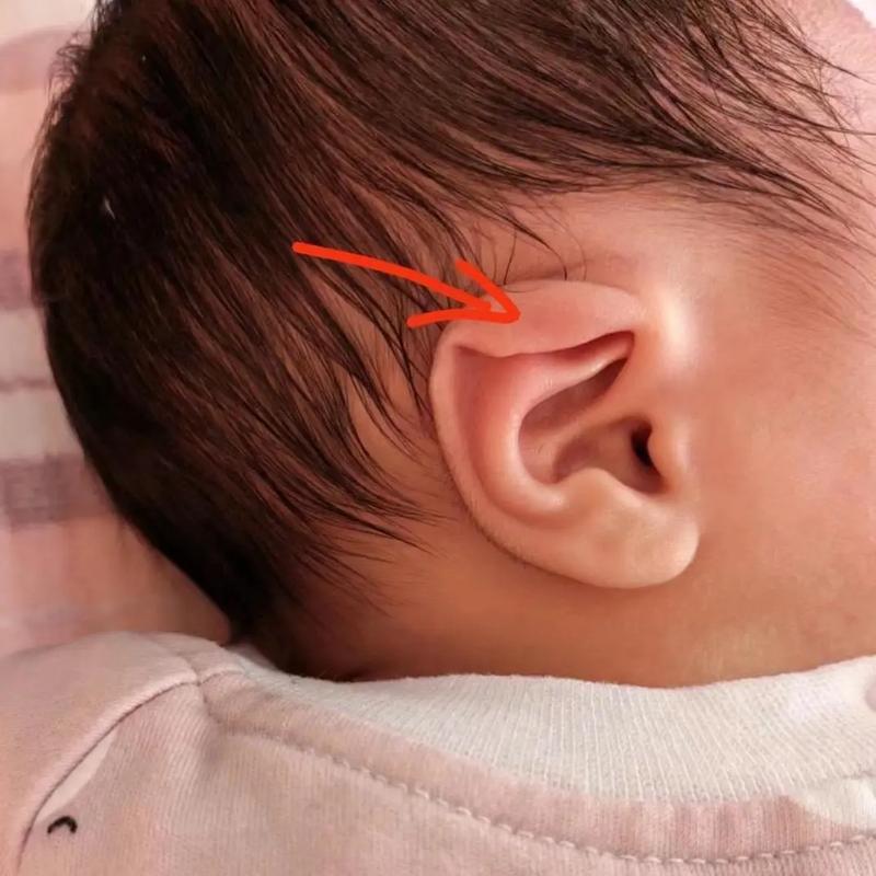 新生儿耳朵需要揪吗？揪耳朵会影响听力发育吗？-第3张图片-郑州医学网