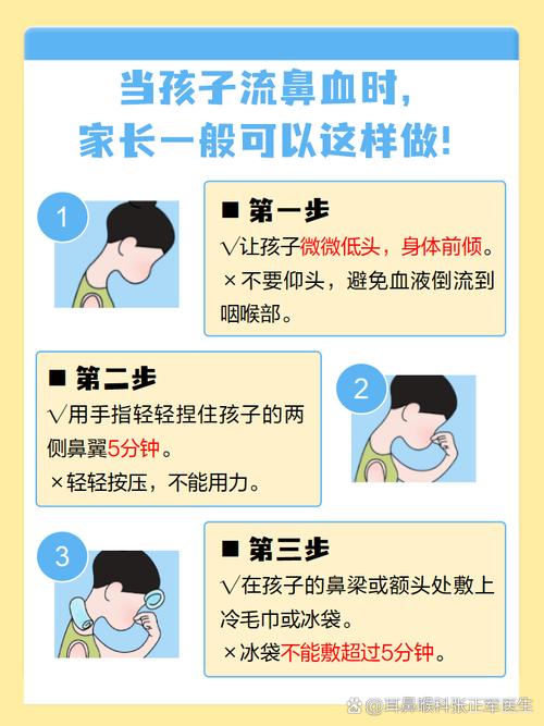 儿童鼻子出血是上火还是疾病信号？日常护理该注意什么？-第3张图片-郑州医学网