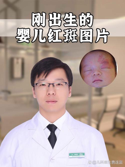 新生儿花斑纹会影响健康发育吗?需要干预治疗吗?-第1张图片-郑州医学网 新生儿花斑纹会影响健康发育吗?需要干预治疗吗?-第1张图片-郑州医学网