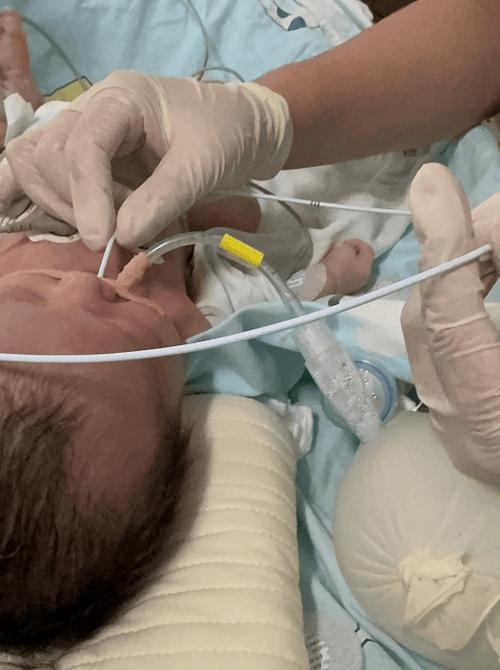 新生儿做胸片检查的辐射剂量究竟有多大？会对宝宝健康造成潜在风险吗？-第1张图片-郑州医学网