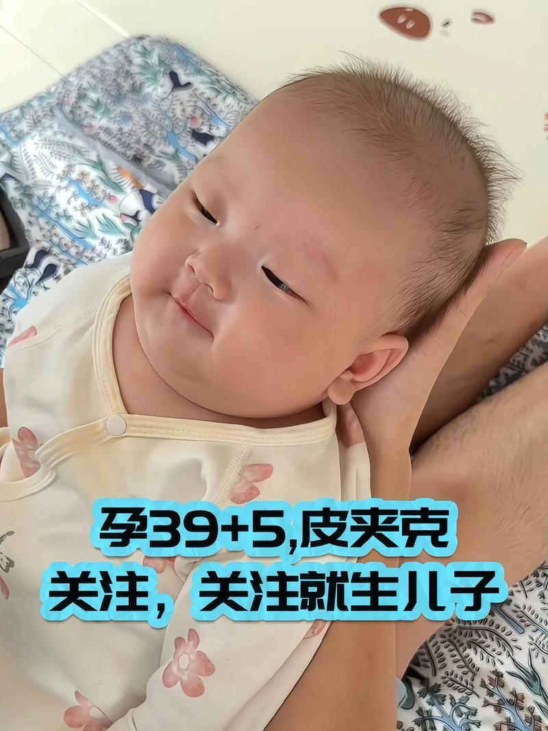 孕期脸部浮肿与胎儿性别有关联吗？科学依据是什么？-第2张图片-郑州医学网