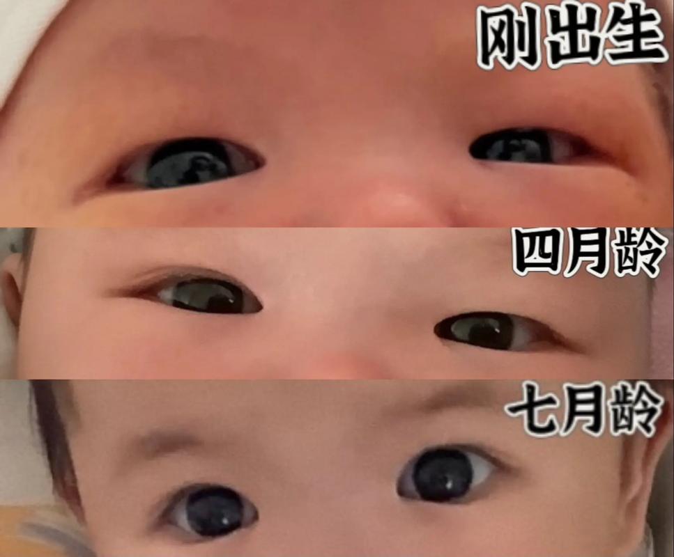 新生儿眼睛是否真的怕光？刚出生的宝宝该避免强光刺激吗？-第3张图片-郑州医学网