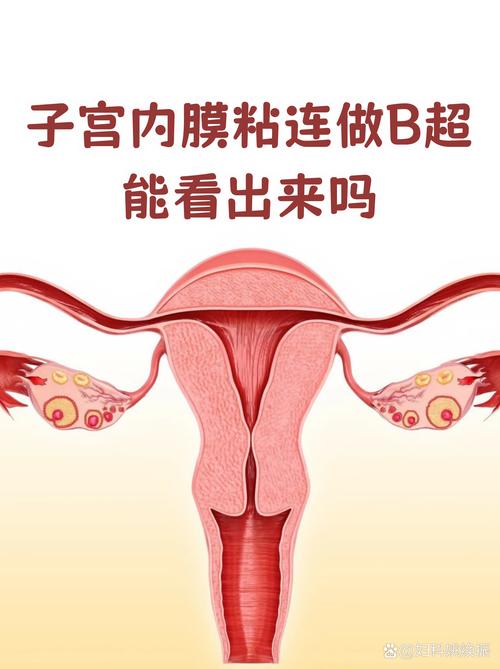 宫腔粘连带在孕期图片中会随孕周变化吗？对胎儿发育有何影响？-第3张图片-郑州医学网