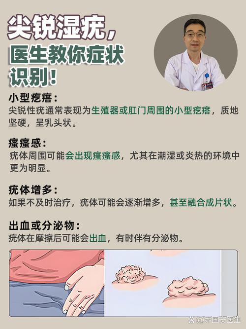 孕期尖锐湿庞怎么治疗-第1张图片-郑州医学网