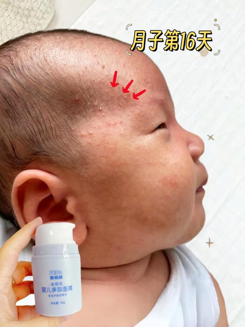 新生儿皮肤娇嫩，能用儿童霜吗？会不会有刺激或过敏风险？-第1张图片-郑州医学网