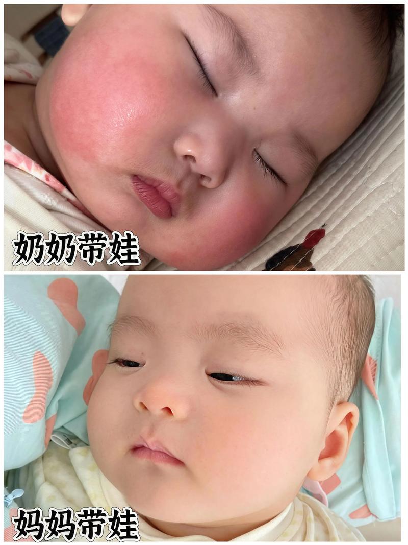 新生儿皮肤娇嫩，能用儿童霜吗？会不会有刺激或过敏风险？-第3张图片-郑州医学网