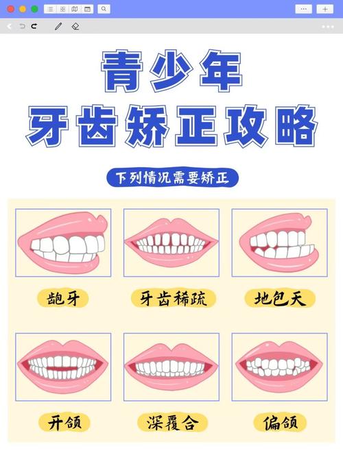 儿童牙齿矫正的最佳年龄是几岁?不同错颌畸形该何时干预?-第2张图片-郑州医学网 儿童牙齿矫正的最佳年龄是几岁?不同错颌畸形该何时干预?-第2张图片-郑州医学网