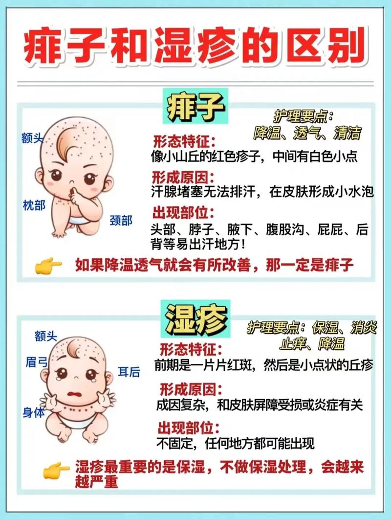 新生儿热疹反复发作难消退？科学护理与正确处理方法有哪些？-第3张图片-郑州医学网