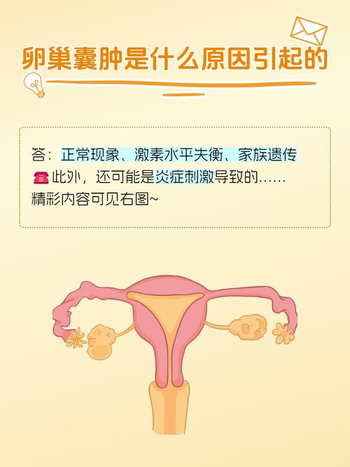 孕期卵巢囊肿是怎么形成的？对胎儿和孕妇有什么影响？需要治疗吗？-第3张图片-郑州医学网