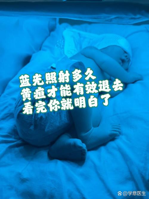 新生儿黄疸照蓝光的标准具体有哪些？不同日龄宝宝的数值要求有何差异？-第1张图片-郑州医学网
