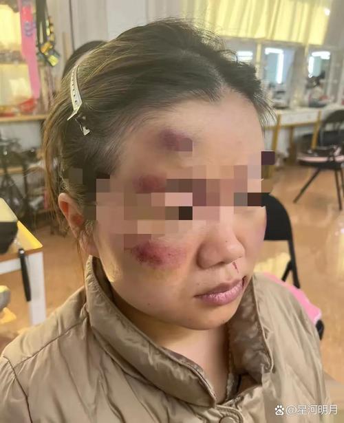 怀孕期间丈夫动手打人，为何暴力会伸向孕期伴侣？-第2张图片-郑州医学网