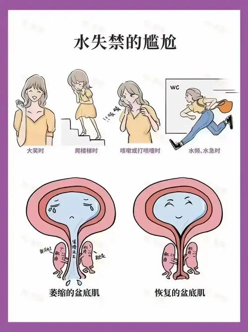 孕期漏尿是正常现象吗?一般从什么时候开始出现?-第2张图片-郑州医学网 孕期漏尿是正常现象吗?一般从什么时候开始出现?-第2张图片-郑州医学网