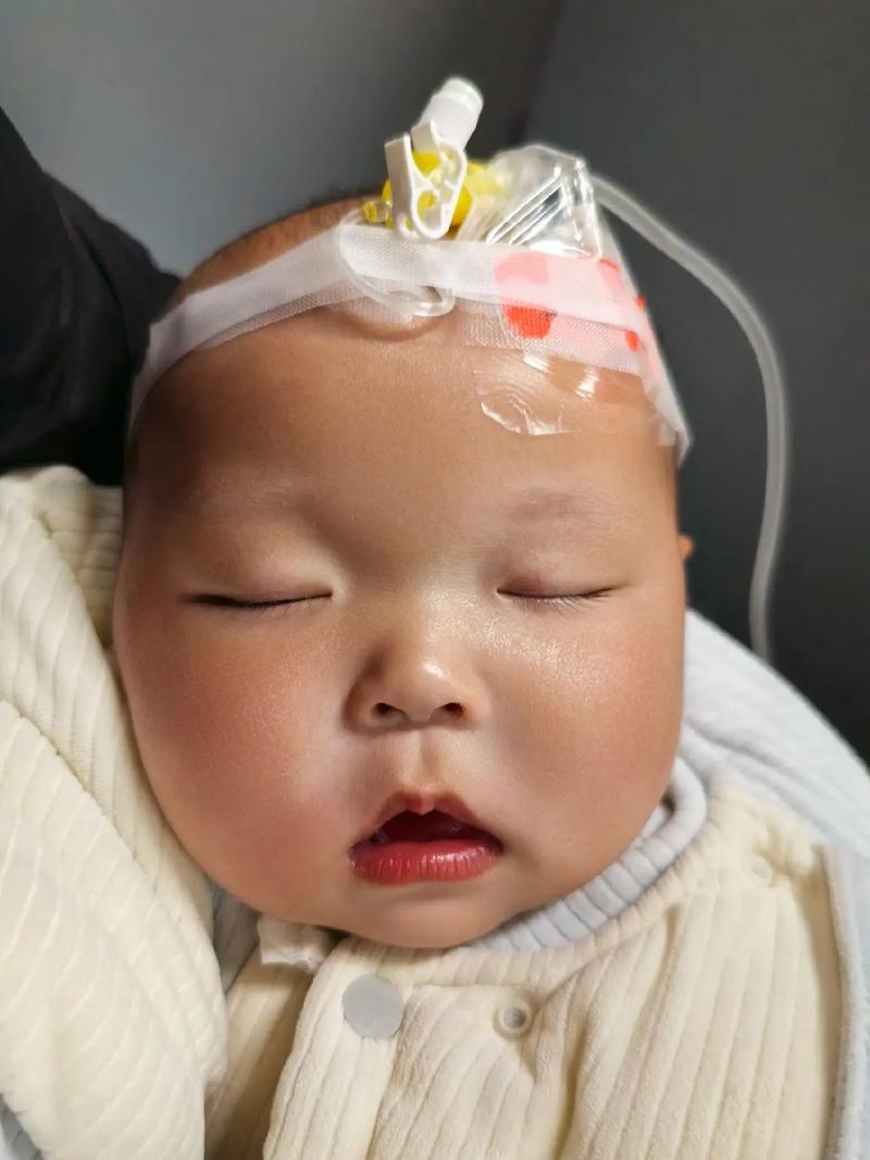 新生儿支气管多少天好-第3张图片-郑州医学网